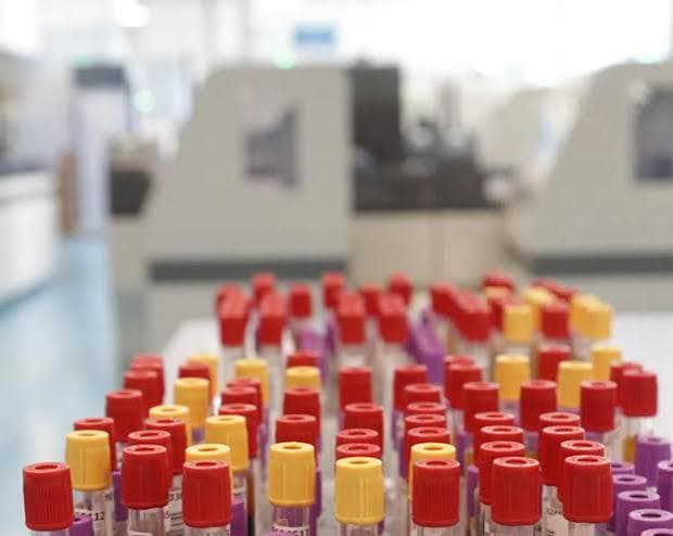 Otto casi di malaria a Francoforte: tre morti vicino all'aeroporto